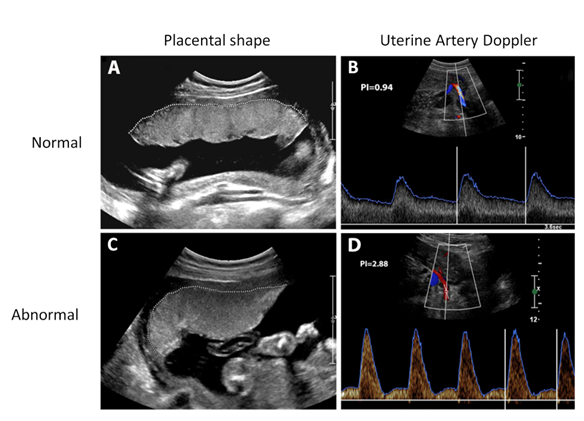 Normal and abnormal ultrasound results images for comparison