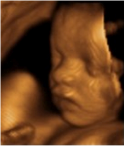 image of baby in ultrasound