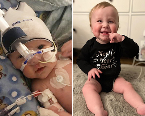 beautiful baby that went through a medical procedure